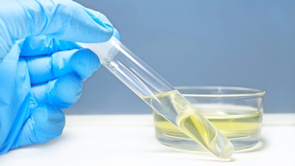 Urine drug screening test used for cocaine detection