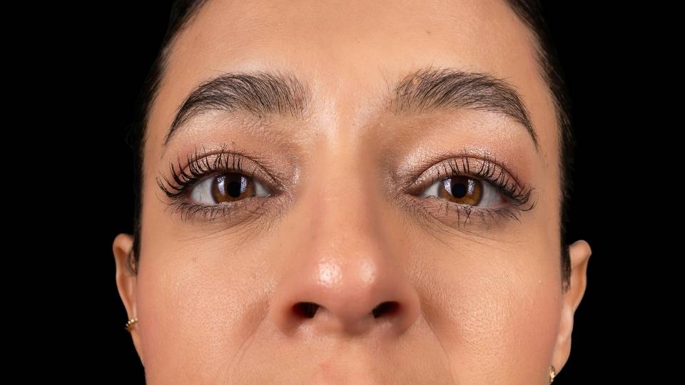 alcoholic eyes can make pupils respond more slowly.